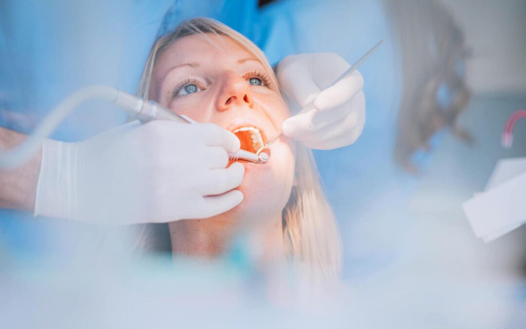 Détartrage des dents