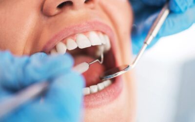 Les soins conservateurs dentaires