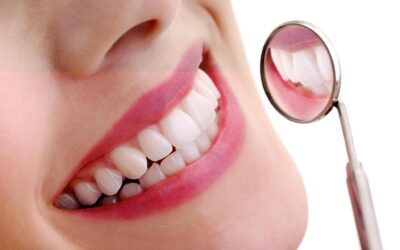 Pose d’implants dentaires sur le maxillaire