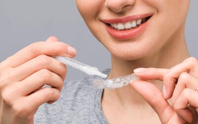 Techniques de blanchiment des dents