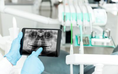 Présentation du cas clinique Inlay Onlay